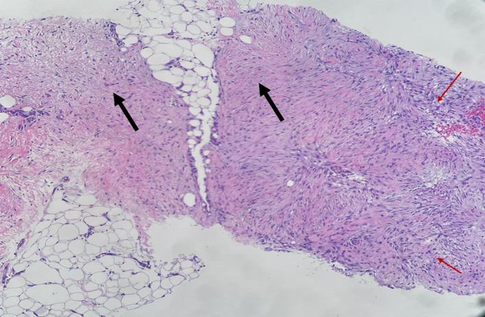 https://cdn.ncbi.nlm.nih.gov/pmc/blobs/66cc/11092408/a1e2735748ac/wjon-15-394-g003.jpg