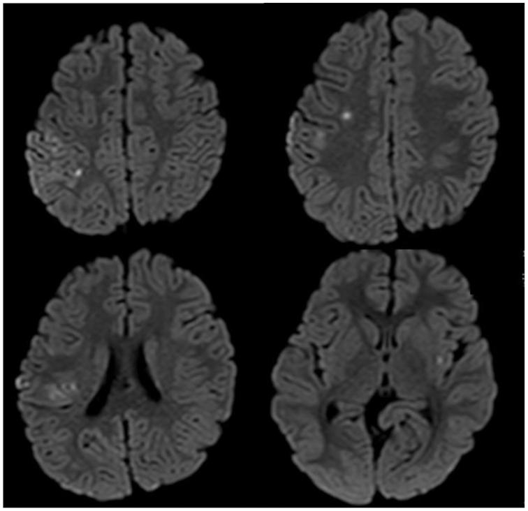 https://cdn.ncbi.nlm.nih.gov/pmc/blobs/66ce/11277370/87d6328720ad/gr1.jpg