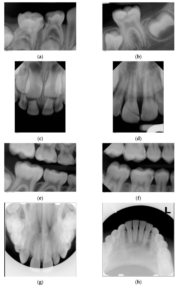 https://cdn.ncbi.nlm.nih.gov/pmc/blobs/66d4/10141634/10b0584ce4e5/jpm-13-00692-g001.jpg