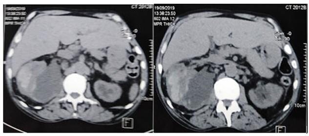 https://cdn.ncbi.nlm.nih.gov/pmc/blobs/66d8/9341300/006028003025/rjac329f1.jpg