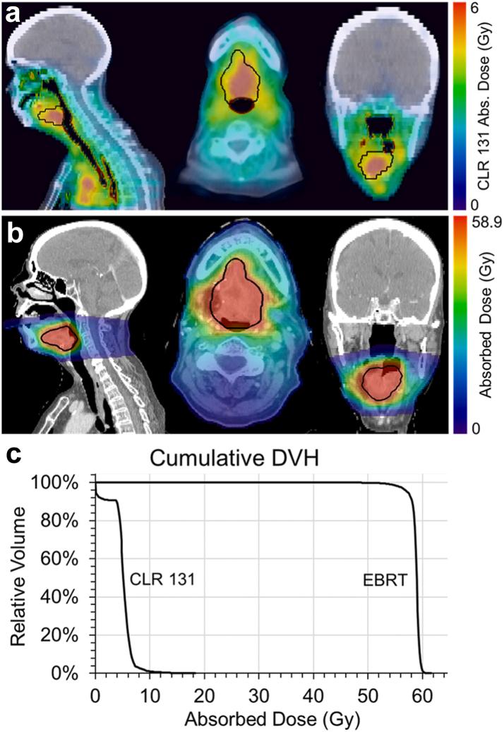 https://cdn.ncbi.nlm.nih.gov/pmc/blobs/66dd/11700259/c353b0118978/gr1.jpg