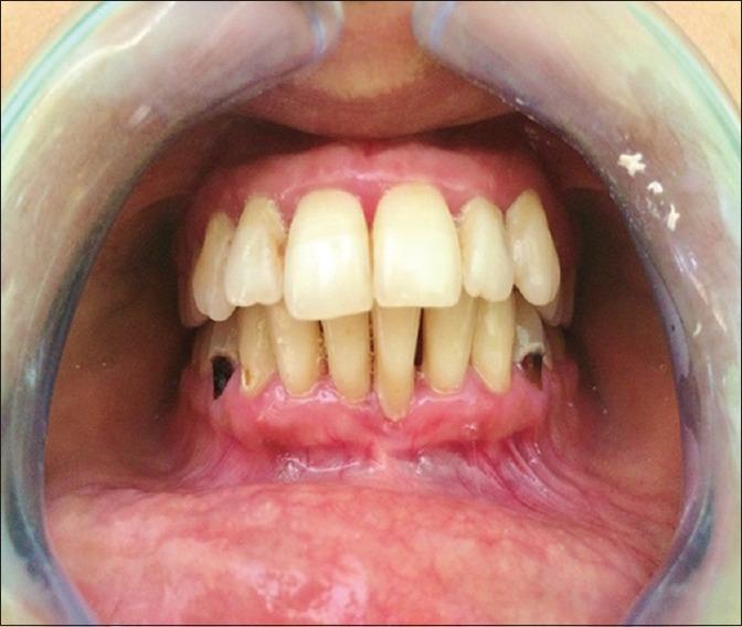 https://cdn.ncbi.nlm.nih.gov/pmc/blobs/66e1/5341317/d625832b8442/JISP-20-417-g009.jpg