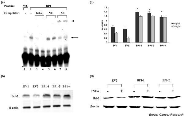 https://cdn.ncbi.nlm.nih.gov/pmc/blobs/66e3/2242656/55292be9a19e/bcr1766-3.jpg