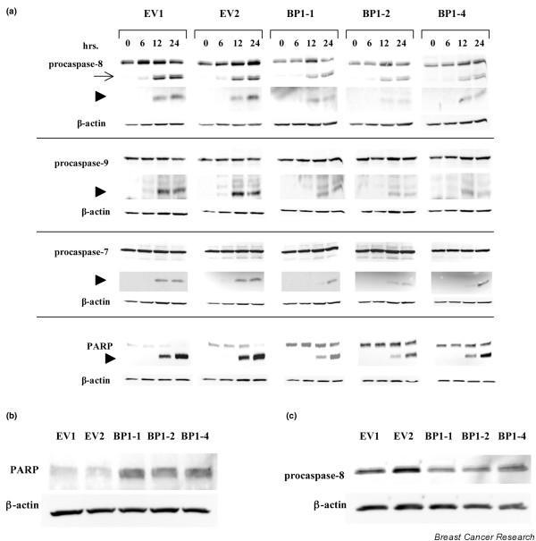 https://cdn.ncbi.nlm.nih.gov/pmc/blobs/66e3/2242656/f1a2bfac9b02/bcr1766-2.jpg