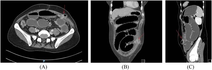 https://cdn.ncbi.nlm.nih.gov/pmc/blobs/66fd/11298635/87ddc8a7def6/gr2.jpg