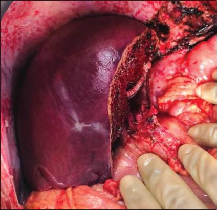 https://cdn.ncbi.nlm.nih.gov/pmc/blobs/6707/11326664/ec761df32beb/JCAS-10-599-g004.jpg