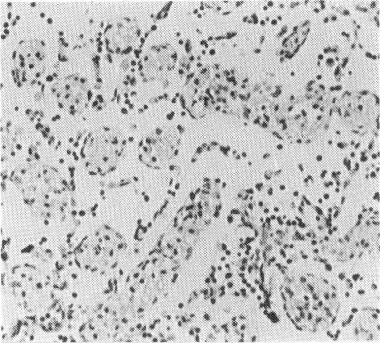 https://cdn.ncbi.nlm.nih.gov/pmc/blobs/670f/2002449/337400a2f032/ijexpath00030-0008-c.jpg