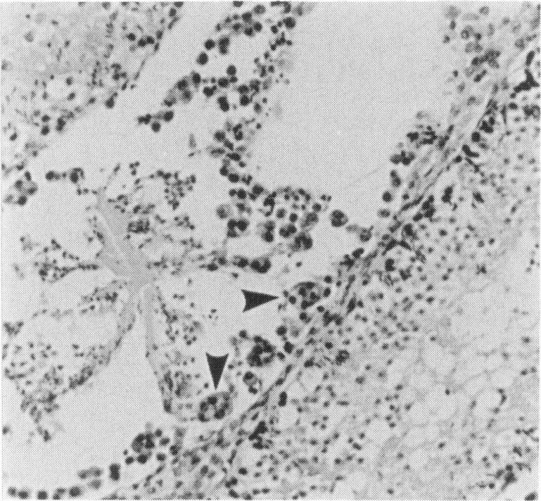 https://cdn.ncbi.nlm.nih.gov/pmc/blobs/670f/2002449/3d9a2a4b44f3/ijexpath00030-0008-a.jpg