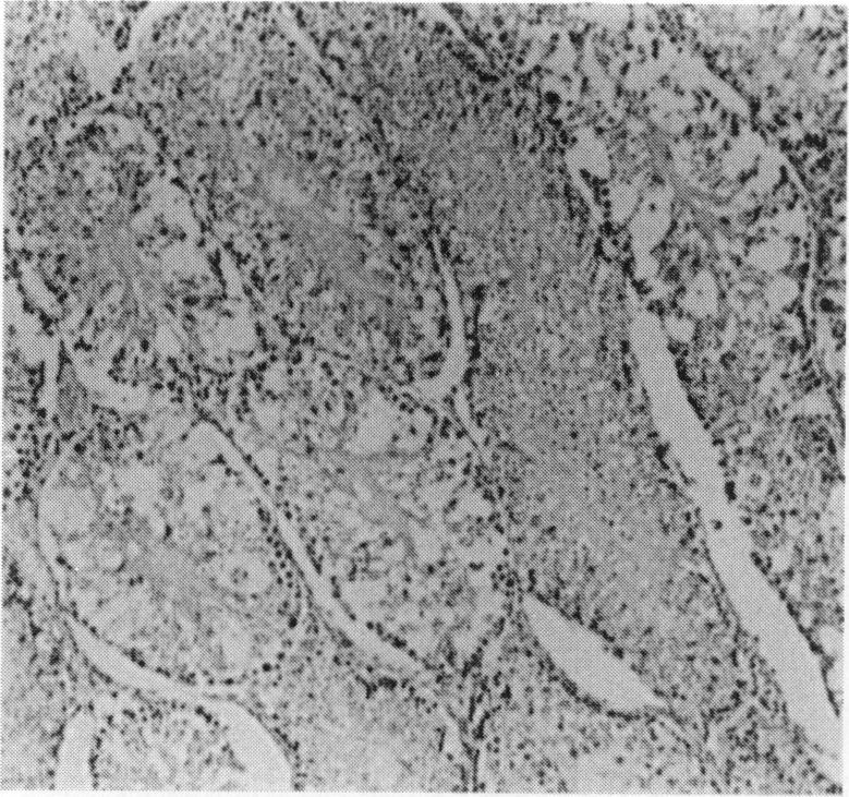 https://cdn.ncbi.nlm.nih.gov/pmc/blobs/670f/2002449/481b8e38f2ed/ijexpath00030-0007-b.jpg