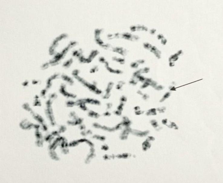 https://cdn.ncbi.nlm.nih.gov/pmc/blobs/6715/9831868/af0f3405d72d/IJHOSCR-16-184-g002.jpg