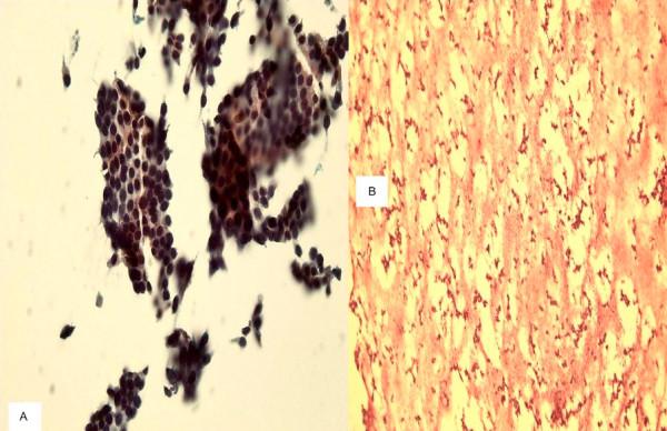 https://cdn.ncbi.nlm.nih.gov/pmc/blobs/6716/2291068/6808df5f237a/1742-6413-5-3-4.jpg