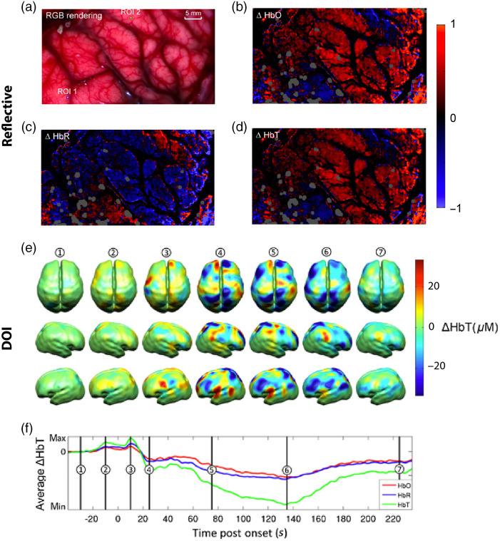 https://cdn.ncbi.nlm.nih.gov/pmc/blobs/671c/9346606/aa438040265e/JBO-027-080901-g006.jpg