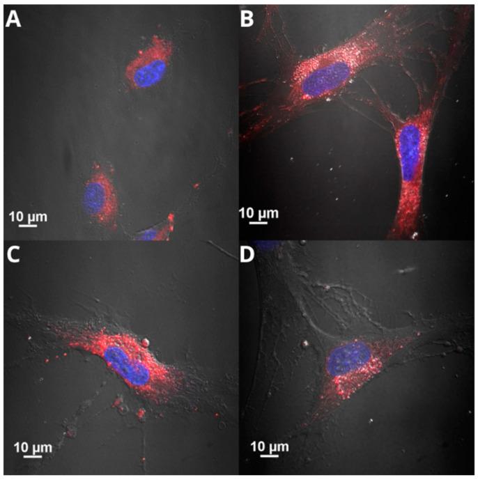 https://cdn.ncbi.nlm.nih.gov/pmc/blobs/6725/11172538/e8bca9a6fc94/ijms-25-05897-g006a.jpg