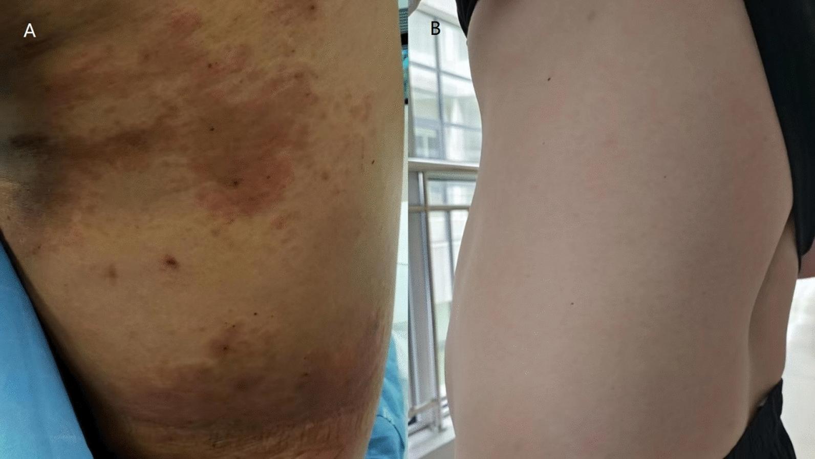 https://cdn.ncbi.nlm.nih.gov/pmc/blobs/6727/11974064/5ee90ce98b0f/13256_2025_5143_Fig1_HTML.jpg