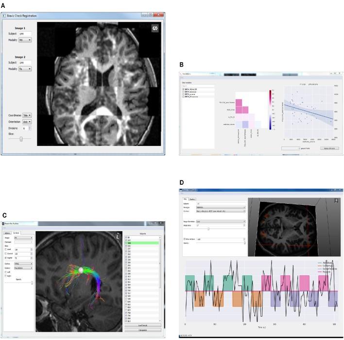 https://cdn.ncbi.nlm.nih.gov/pmc/blobs/6727/4993811/d2a5ff8d12a2/fninf-10-00036-g0003.jpg