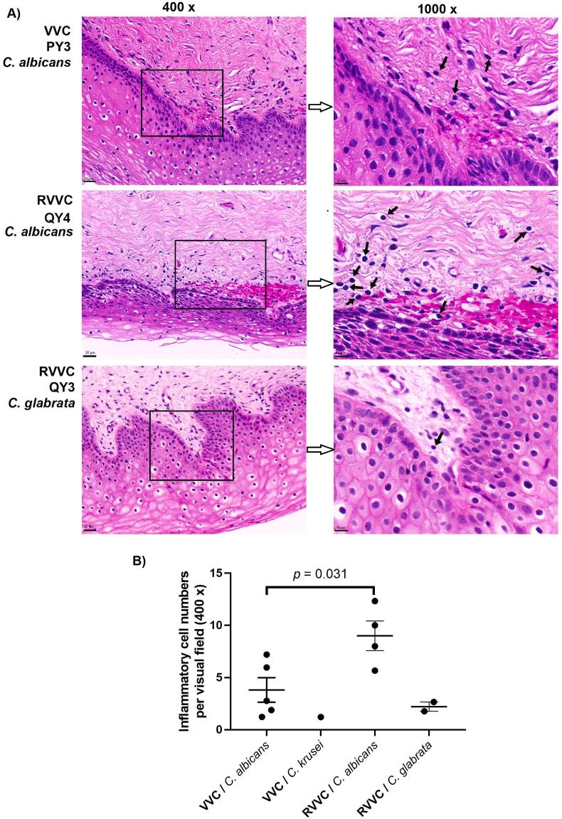https://cdn.ncbi.nlm.nih.gov/pmc/blobs/672b/10630605/8224f967492d/gr6.jpg