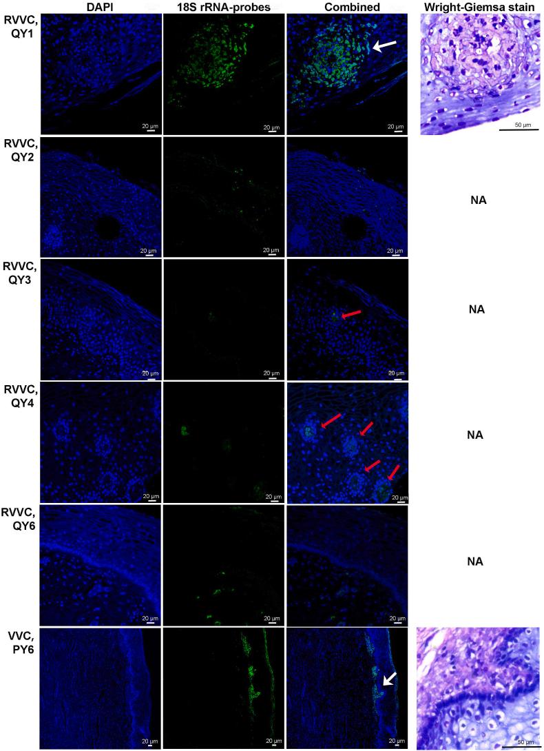https://cdn.ncbi.nlm.nih.gov/pmc/blobs/672b/10630605/95b548cb682f/gr4.jpg