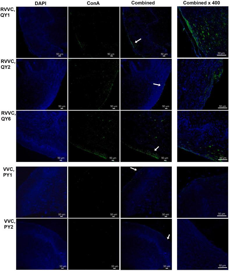 https://cdn.ncbi.nlm.nih.gov/pmc/blobs/672b/10630605/c7d3391a5971/gr3.jpg