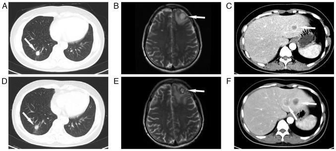 https://cdn.ncbi.nlm.nih.gov/pmc/blobs/672e/11058636/87ba0f20b45f/ol-27-06-14409-g02.jpg