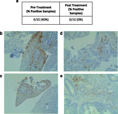 https://cdn.ncbi.nlm.nih.gov/pmc/blobs/672e/5067917/24707cf5667e/40425_2016_163_Fig5_HTML.jpg