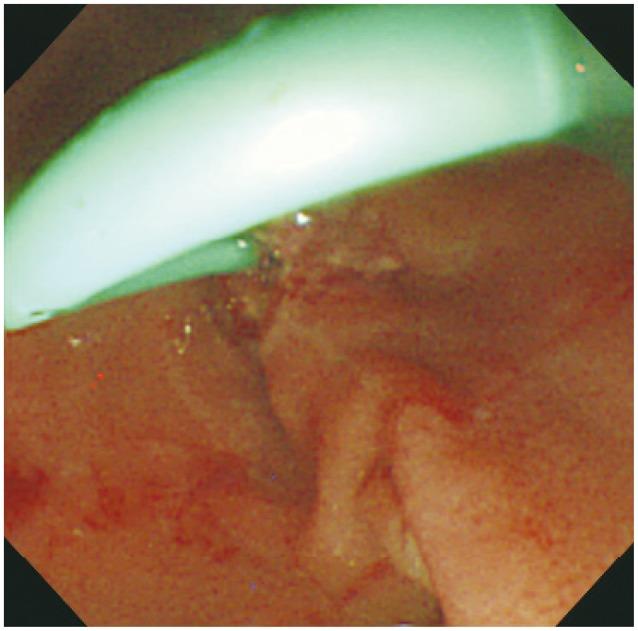 https://cdn.ncbi.nlm.nih.gov/pmc/blobs/6739/4058538/7be4d9b72dca/ce-47-217-g002.jpg