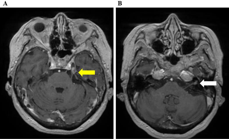https://cdn.ncbi.nlm.nih.gov/pmc/blobs/6739/8024967/44ecfd8a242f/1349-7235-60-0855-g003.jpg