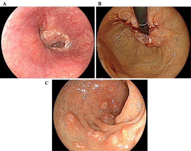https://cdn.ncbi.nlm.nih.gov/pmc/blobs/6739/8024967/e345a606f3c8/1349-7235-60-0855-g001.jpg