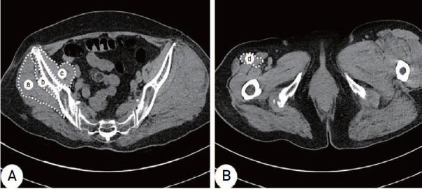 https://cdn.ncbi.nlm.nih.gov/pmc/blobs/6739/8931948/4818668ebef0/hp-34-10-g002.jpg