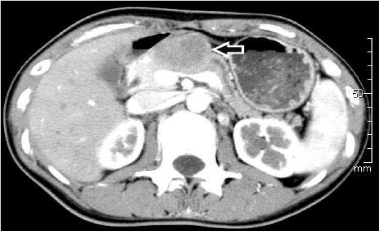 https://cdn.ncbi.nlm.nih.gov/pmc/blobs/673d/7607418/1c55887c33d9/gr11.jpg
