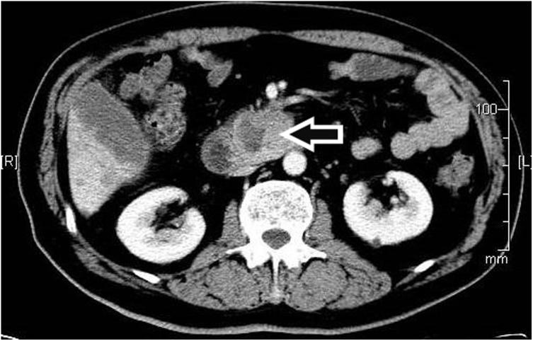 https://cdn.ncbi.nlm.nih.gov/pmc/blobs/673d/7607418/b363da45fac0/gr1.jpg