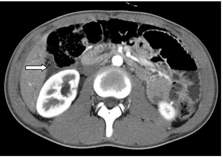 https://cdn.ncbi.nlm.nih.gov/pmc/blobs/673e/3096030/e8dd3a3dc809/pr-2009-1-e8-g003.jpg