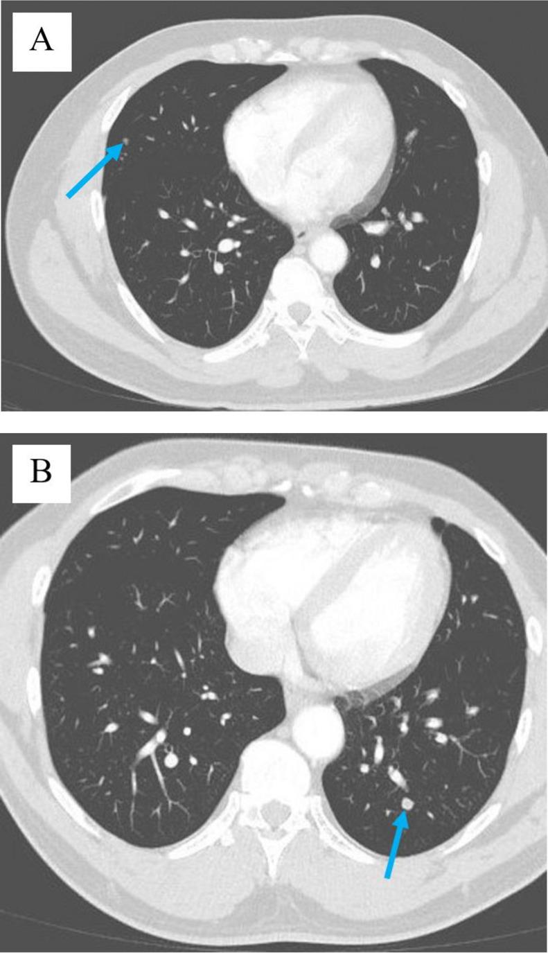 https://cdn.ncbi.nlm.nih.gov/pmc/blobs/673e/9619145/353822180d5c/gr9.jpg