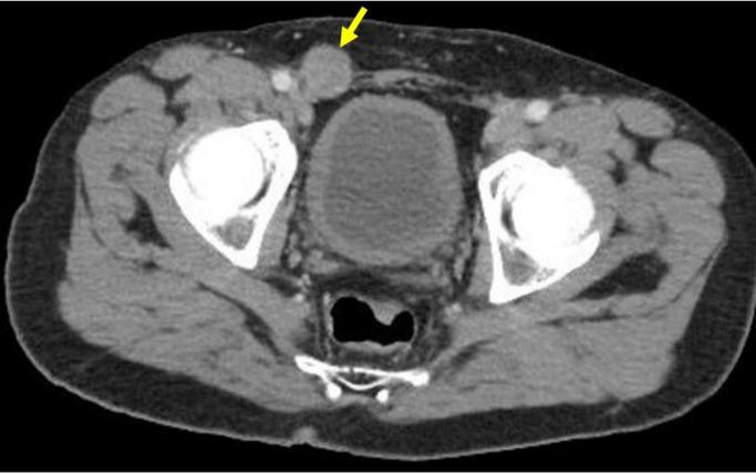 https://cdn.ncbi.nlm.nih.gov/pmc/blobs/673e/9619145/a4c1e39fd9ad/gr8.jpg