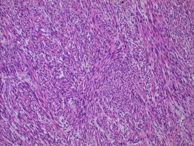 https://cdn.ncbi.nlm.nih.gov/pmc/blobs/673e/9619145/ae1a5d8917ce/gr3.jpg