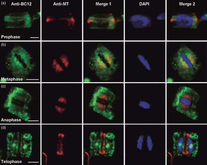 https://cdn.ncbi.nlm.nih.gov/pmc/blobs/673f/3440585/dc1b42004e71/tpj0063-0312-f8.jpg
