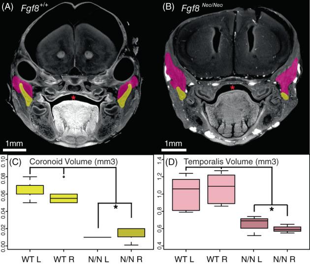 https://cdn.ncbi.nlm.nih.gov/pmc/blobs/673f/9796670/987a3cad3d60/DVDY-251-1711-g008.jpg