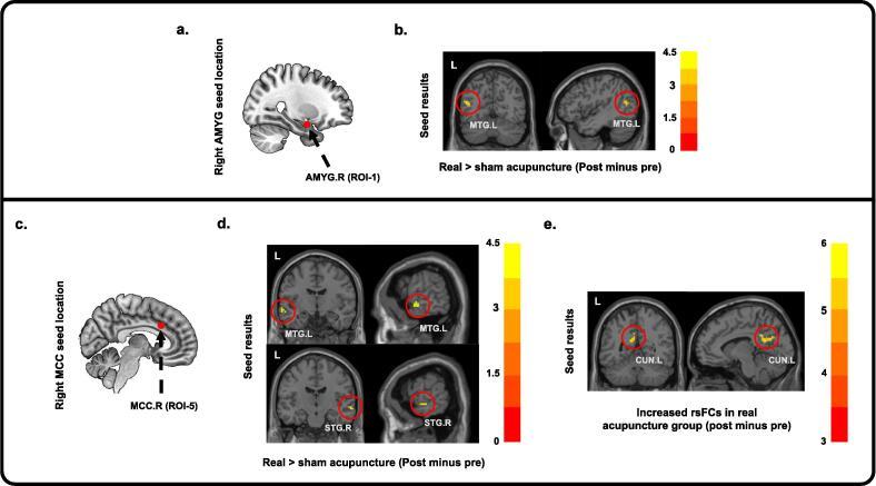https://cdn.ncbi.nlm.nih.gov/pmc/blobs/6746/9468576/d8a7482e6296/gr4.jpg