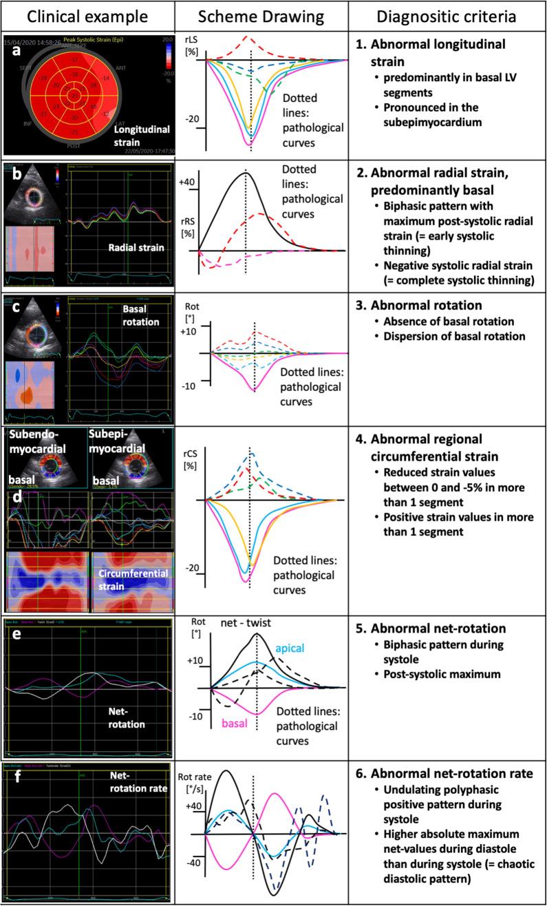 https://cdn.ncbi.nlm.nih.gov/pmc/blobs/674b/7688100/c03dff6b0fa9/392_2020_1727_Fig5_HTML.jpg