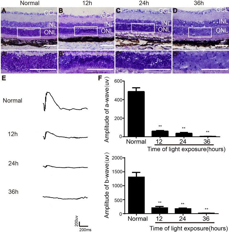 https://cdn.ncbi.nlm.nih.gov/pmc/blobs/674e/5696246/0be1f8078d2d/oncotarget-08-93087-g001.jpg