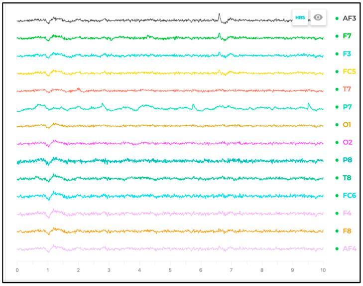 https://cdn.ncbi.nlm.nih.gov/pmc/blobs/674f/12390388/6810428a816f/sensors-25-04946-g007.jpg