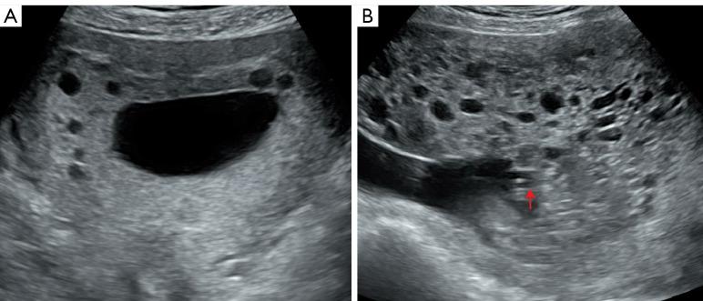 https://cdn.ncbi.nlm.nih.gov/pmc/blobs/6751/11400704/6c95a1aec3ac/qims-14-09-6934-f1.jpg