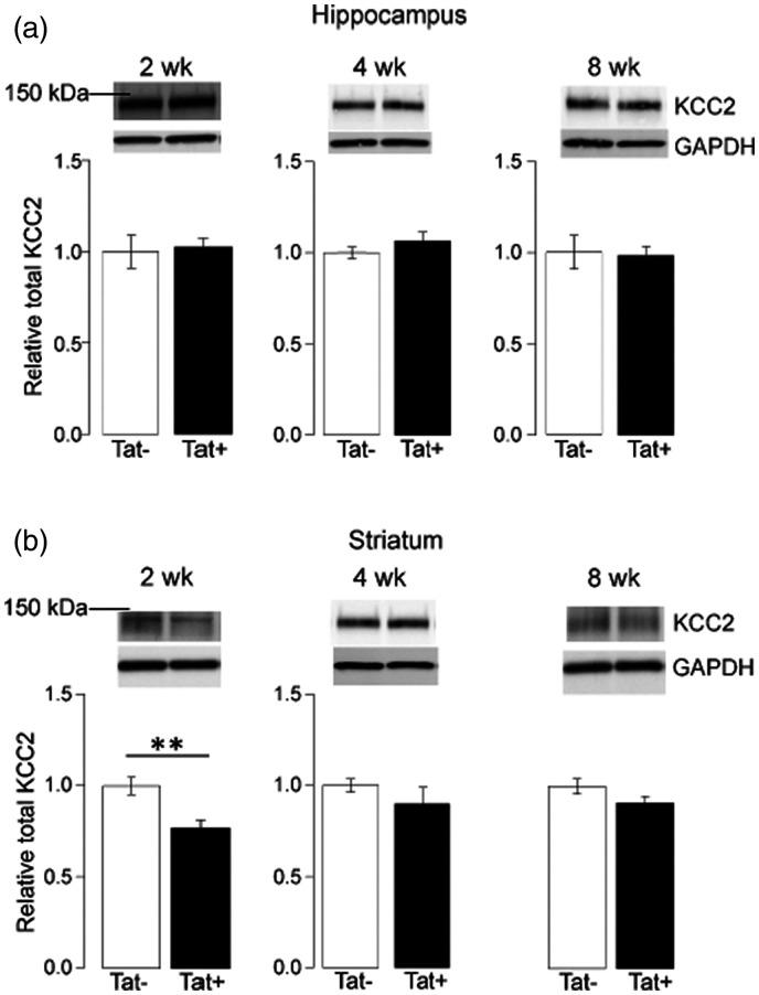 https://cdn.ncbi.nlm.nih.gov/pmc/blobs/6751/8404672/ee871f4e9cd6/10.1177_17590914211022089-fig1.jpg