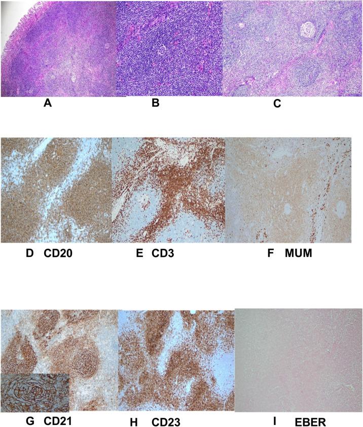 https://cdn.ncbi.nlm.nih.gov/pmc/blobs/6764/12005995/e4e8fa7a49c5/fonc-15-1563545-g004.jpg