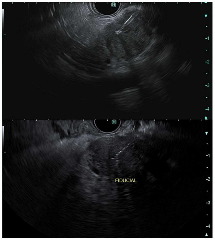 https://cdn.ncbi.nlm.nih.gov/pmc/blobs/6764/8946253/c6e1586b4403/cancers-14-01373-g005.jpg
