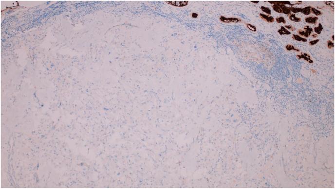 https://cdn.ncbi.nlm.nih.gov/pmc/blobs/6768/11298843/a96fdc090f72/gr5.jpg