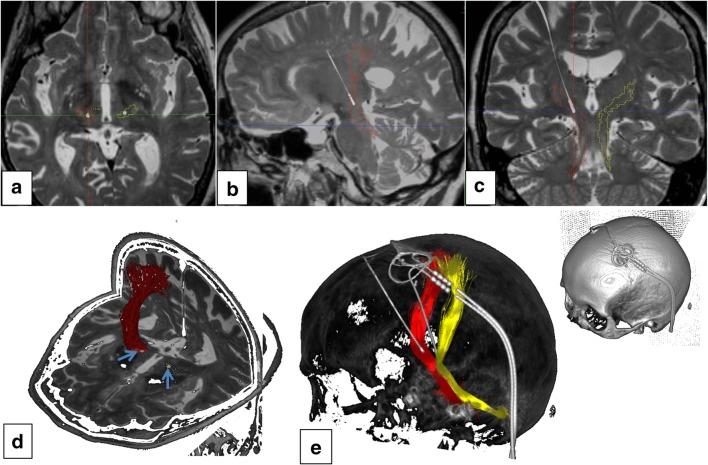 https://cdn.ncbi.nlm.nih.gov/pmc/blobs/676c/7156360/3ef8fae46a7e/701_2020_4248_Fig1_HTML.jpg