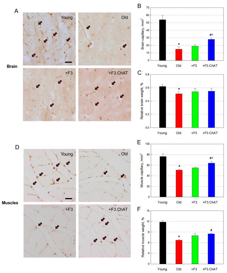 https://cdn.ncbi.nlm.nih.gov/pmc/blobs/6770/10706332/4b649f1831e0/cells-12-02711-g006.jpg