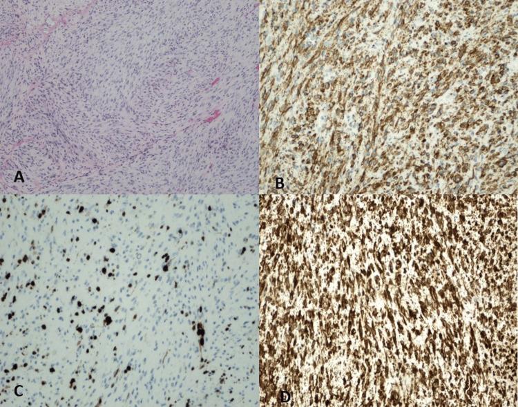 https://cdn.ncbi.nlm.nih.gov/pmc/blobs/6773/11312426/bc9720bcb607/cureus-0016-00000064232-i02.jpg