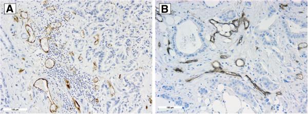 https://cdn.ncbi.nlm.nih.gov/pmc/blobs/677a/3816792/15c66719420c/1746-1596-8-170-1.jpg
