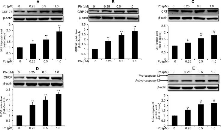https://cdn.ncbi.nlm.nih.gov/pmc/blobs/677b/5710913/aeb681f9c5b2/oncotarget-08-91162-g001.jpg